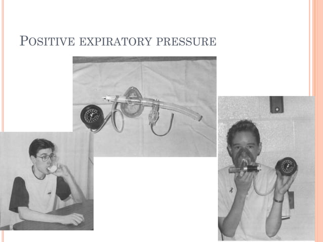 Techniques of chest physiotherapy | PPTX