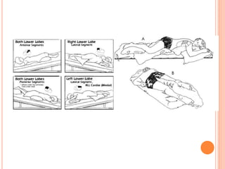 Techniques of chest physiotherapy | PPTX