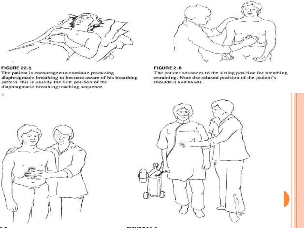 Techniques of chest physiotherapy
