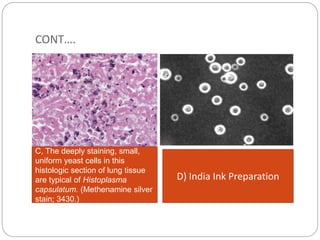 Techniques of diagnostic Mycology- 5 hours | PPTX