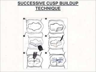 Cusp Process Techniques of direct composite restoration | PPT