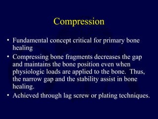 Bone Pressed Approach basic methods of fracture fixation and stepwise approach | PPT