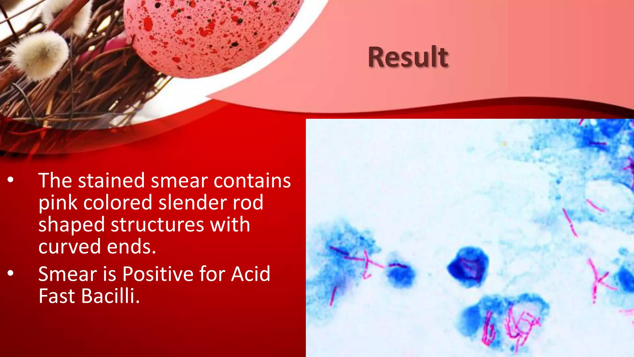 Result
• The stained smear contains
pink colored slender rod
shaped structures with
curved ends.
• Smear is Positive for Acid
Fast Bacilli.
 