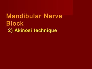 Mandibular Nerve
Block
2) Akinosi technique

 