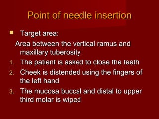 Point of needle insertion
Target area:
Area between the vertical ramus and
maxillary tuberosity
1. The patient is asked to close the teeth
2. Cheek is distended using the fingers of
the left hand
3. The mucosa buccal and distal to upper
third molar is wiped


 