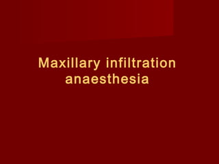 Maxillary infiltration
anaesthesia

 