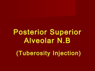 Posterior Superior
Alveolar N.B
(Tuberosity Injection)

 