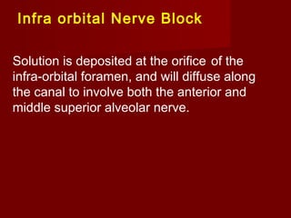 Infra orbital Nerve Block
Solution is deposited at the orifice of the
infra-orbital foramen, and will diffuse along
the canal to involve both the anterior and
middle superior alveolar nerve.

 