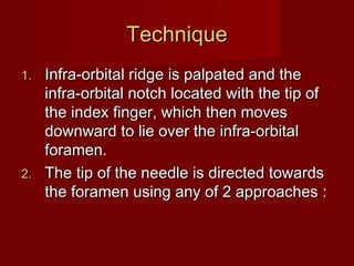 Technique
Infra-orbital ridge is palpated and the
infra-orbital notch located with the tip of
the index finger, which then moves
downward to lie over the infra-orbital
foramen.
2. The tip of the needle is directed towards
the foramen using any of 2 approaches :
1.

 