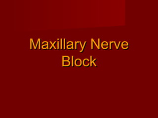 Maxillary Nerve
Block

 