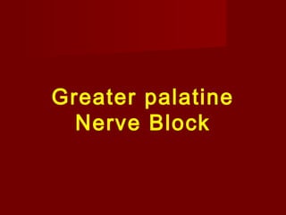 Greater palatine
Nerve Block

 