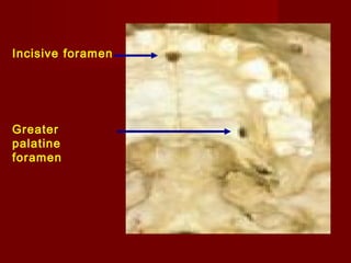 Incisive foramen

Greater
palatine
foramen

 
