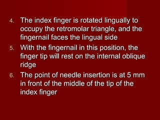 The index finger is rotated lingually to
occupy the retromolar triangle, and the
fingernail faces the lingual side
5. With the fingernail in this position, the
finger tip will rest on the internal oblique
ridge
6. The point of needle insertion is at 5 mm
in front of the middle of the tip of the
index finger
4.

 