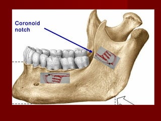 Coronoid
notch

 