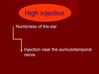 High injection
Numbness of the ear

Injection near the auriculotemporal
nerve

 