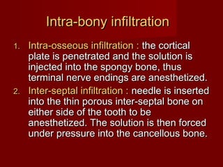 Intra-bony infiltration
Intra-osseous infiltration : the cortical
plate is penetrated and the solution is
injected into the spongy bone, thus
terminal nerve endings are anesthetized.
2. Inter-septal infiltration : needle is inserted
into the thin porous inter-septal bone on
either side of the tooth to be
anesthetized. The solution is then forced
under pressure into the cancellous bone.
1.

 