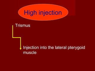 High injection
Trismus

Injection into the lateral pterygoid
muscle

 