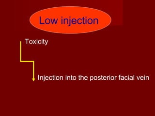 Low injection
Toxicity

Injection into the posterior facial vein

 