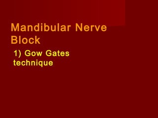 Mandibular Nerve
Block
1) Gow Gates
technique

 