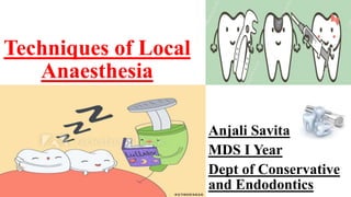 Techniques of Local
Anaesthesia
Anjali Savita
MDS I Year
Dept of Conservative
and Endodontics
 