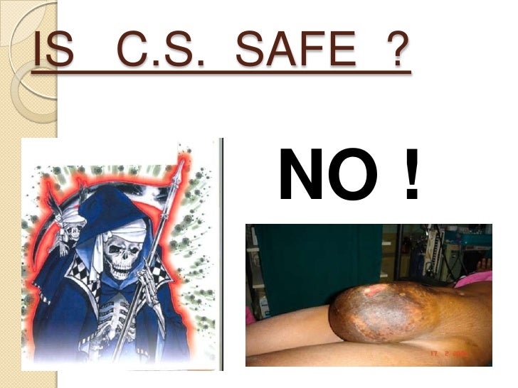 techniques of lscs a review cs full form