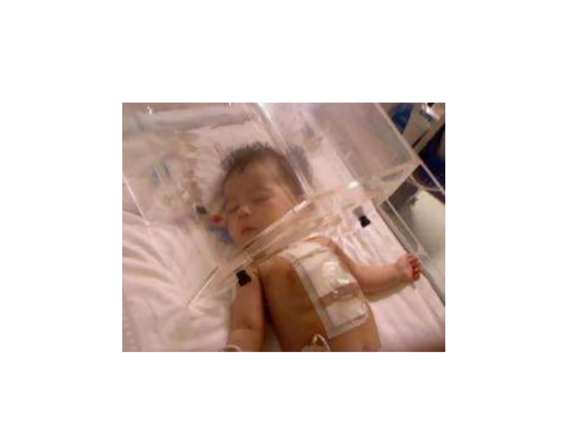 techniques of oxygen delivery.pptx........ | PPT