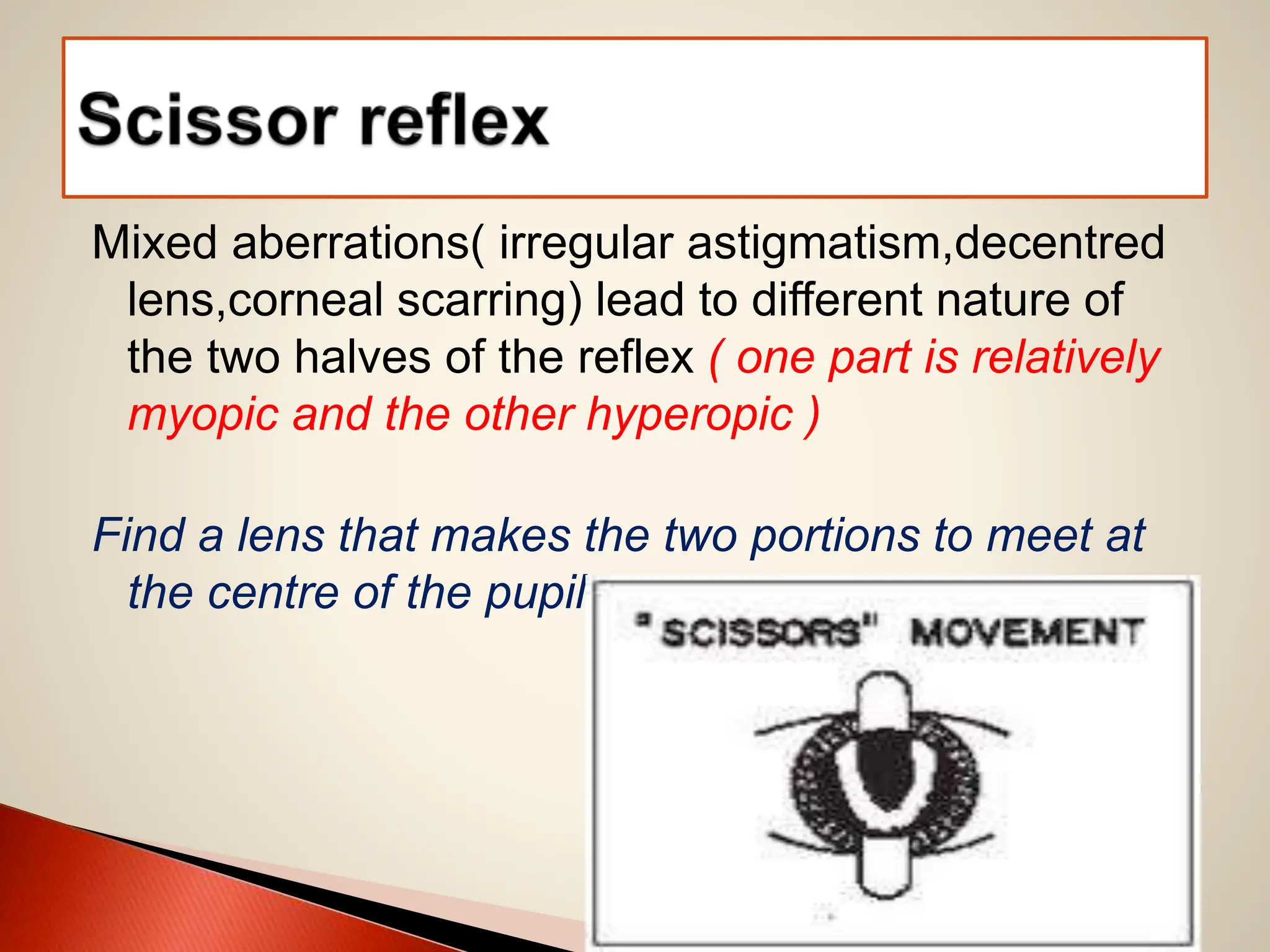 Mixed aberrations( irregular astigmatism,decentred
lens,corneal scarring) lead to different nature of
the two halves of the reflex ( one part is relatively
myopic and the other hyperopic )
Find a lens that makes the two portions to meet at
the centre of the pupil
 