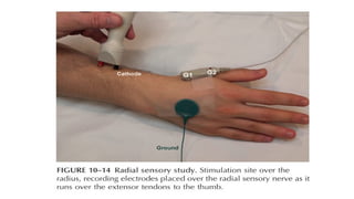 Lateral Coyle Method Routine TECHNIQUES OF ROUTINE UPPER LIMB AND LOWER LIMB.pptx