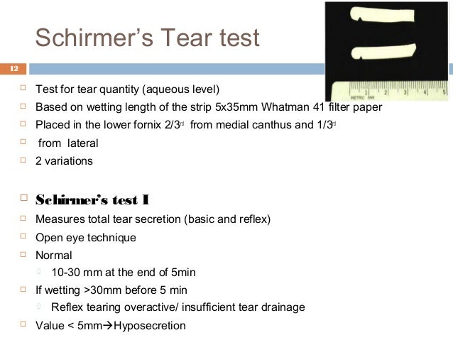schirmer test