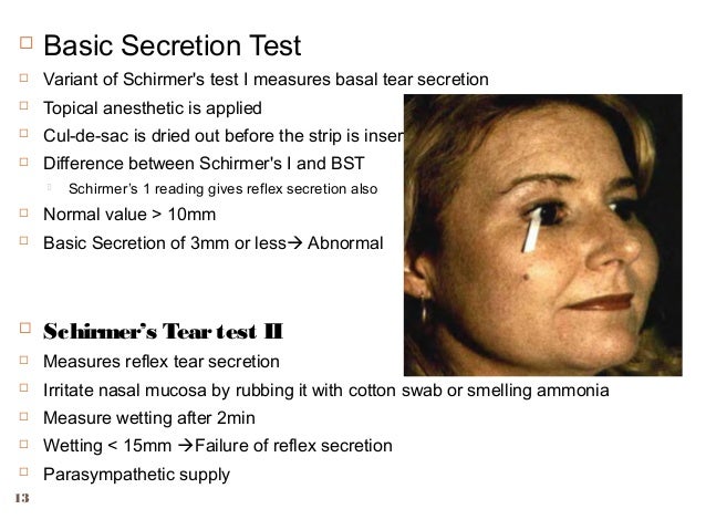 schirmer test