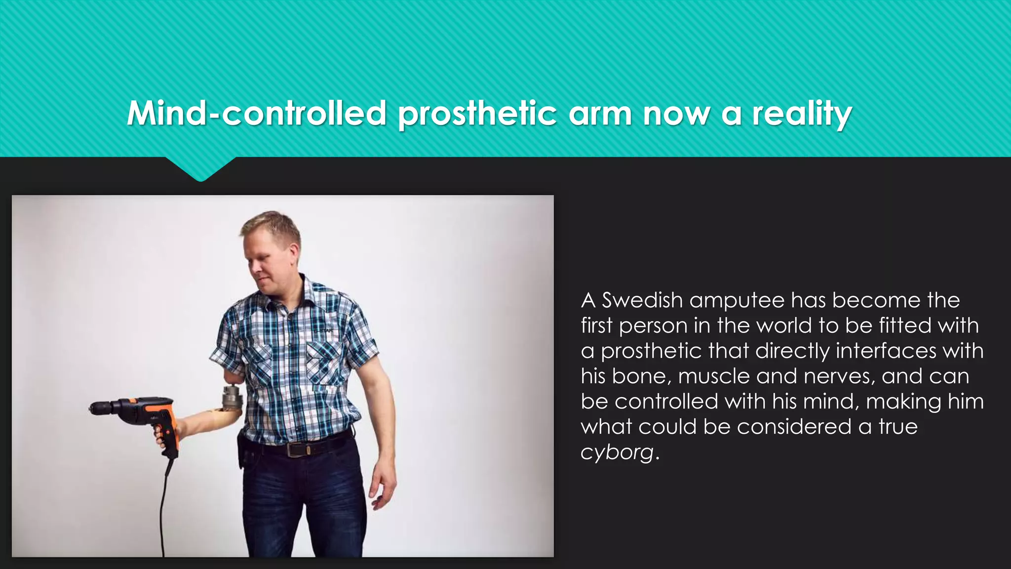 Mind-controlled prosthetic arm now a reality 
A Swedish amputee has become the 
first person in the world to be fitted with 
a prosthetic that directly interfaces with 
his bone, muscle and nerves, and can 
be controlled with his mind, making him 
what could be considered a true 
cyborg. 
 