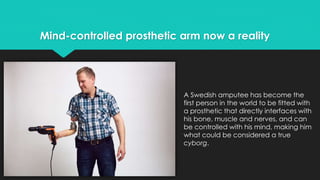 Mind-controlled prosthetic arm now a reality 
A Swedish amputee has become the 
first person in the world to be fitted with 
a prosthetic that directly interfaces with 
his bone, muscle and nerves, and can 
be controlled with his mind, making him 
what could be considered a true 
cyborg. 
 