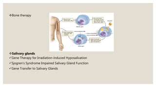 Bone therapy
Salivary glands
Gene Therapy for Irradiation-induced Hyposalivation
Sjogren’s Syndrome Impaired Salivary Gland Function
Gene Transfer to Salivary Glands
 