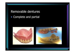 Removable dentures
• Complete and partial
 