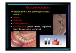 Occlusal indicators
To locate normal and pathologic occlusal
  contacts
• waxes
• Fluid dye
• Colour powders,
• Celluloid foils (power needed to pull out
  form the occluding surfaces)
 