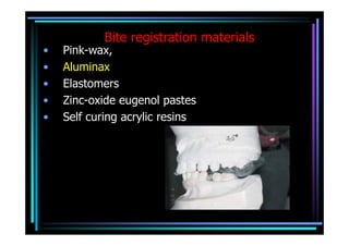 Bite registration materials
•   Pink-wax,
•   Aluminax
•   Elastomers
•   Zinc-oxide eugenol pastes
•   Self curing acrylic resins
 