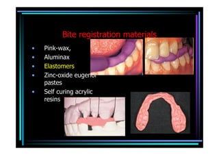 Bite registration materials
•   Pink-wax,
•   Aluminax
•   Elastomers
•   Zinc-oxide eugenol
    pastes
•   Self curing acrylic
    resins
 