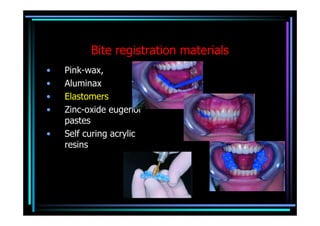 Bite registration materials
•   Pink-wax,
•   Aluminax
•   Elastomers
•   Zinc-oxide eugenol
    pastes
•   Self curing acrylic
    resins
 