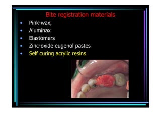 Bite registration materials
•   Pink-wax,
•   Aluminax
•   Elastomers
•   Zinc-oxide eugenol pastes
•   Self curing acrylic resins
 