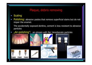 Plaque, debris removing
• Scaling
• Polishing: abrasive pastes that remove superficial stains but do not
  impair the enamel.
  The accidentally exposed dentine, cement is less resistant to abrasive
  particles
• „Air-polishing”: air-stream with Na+-bicarbonate particles
 