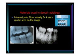 Materials used in dental radiology:
• Intraoral plain films: usually 3- 4 teeth
  can be seen on the image
 