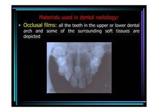Materials used in dental radiology:
• Occlusal films: all the teeth in the upper or lower dental
  arch and some of the surrounding soft tissues are
  depicted
 
