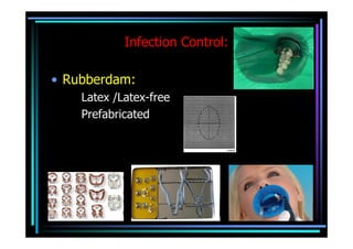 Infection Control:

• Rubberdam:
    Latex /Latex-free
    Prefabricated
 