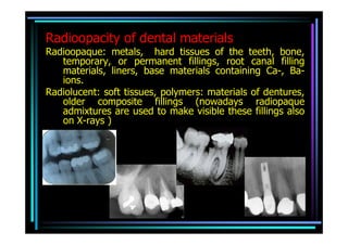 Radioopacity of dental materials
Radioopaque: metals, hard tissues of the teeth, bone,
   temporary, or permanent fillings, root canal filling
   materials, liners, base materials containing Ca-, Ba-
   ions.
Radiolucent: soft tissues, polymers: materials of dentures,
   older composite fillings (nowadays radiopaque
   admixtures are used to make visible these fillings also
   on X-rays )
 