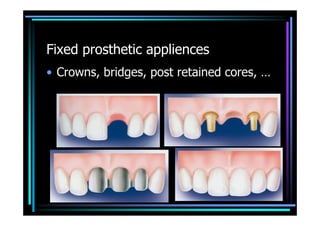 Fixed prosthetic appliences
• Crowns, bridges, post retained cores, …
 
