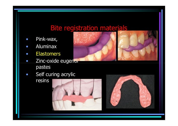 Technological aspects perenyi