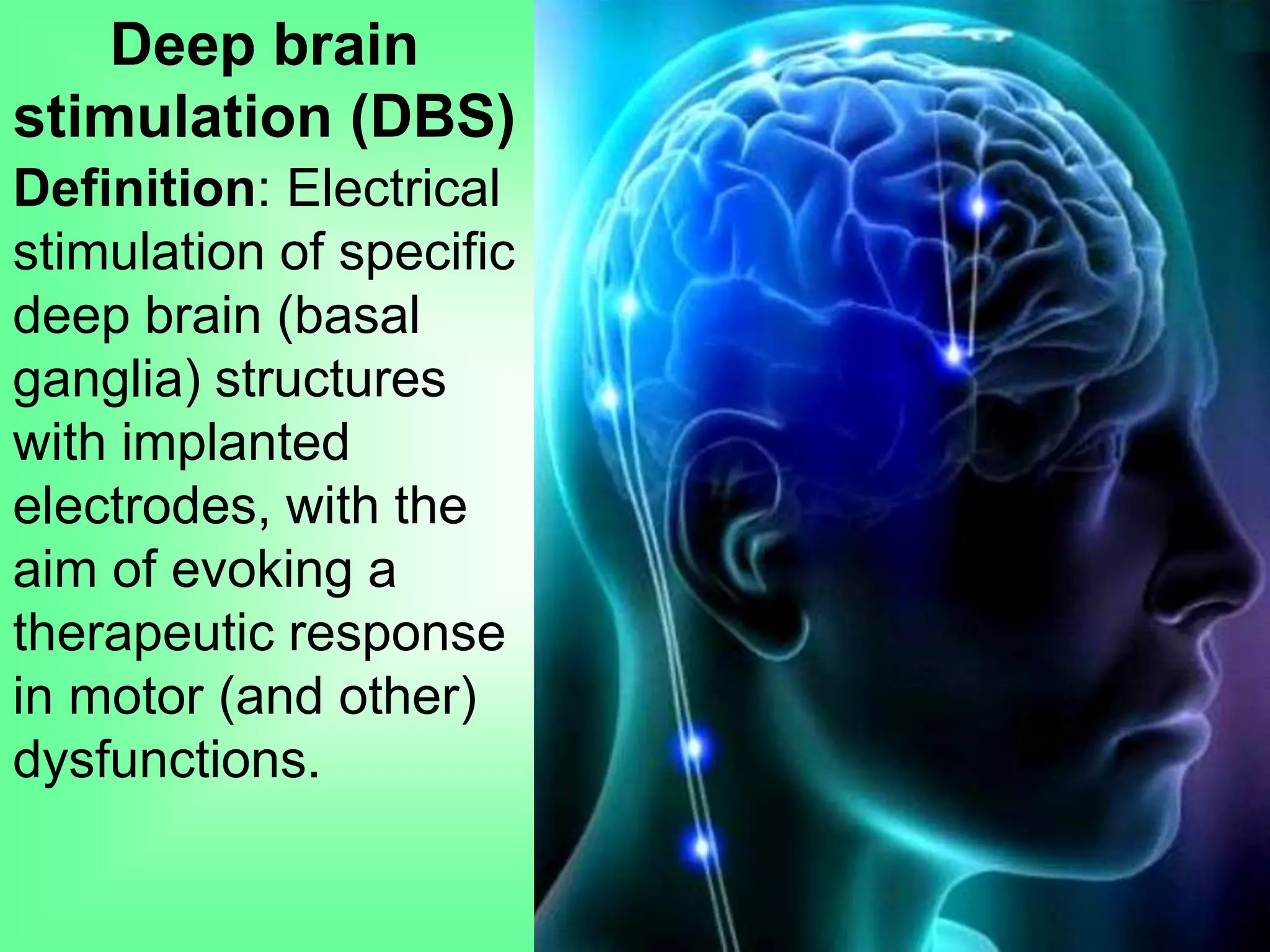 Deep brain
stimulation (DBS)
Definition: Electrical
stimulation of specific
deep brain (basal
ganglia) structures
with implanted
electrodes, with the
aim of evoking a
therapeutic response
in motor (and other)
dysfunctions.
 