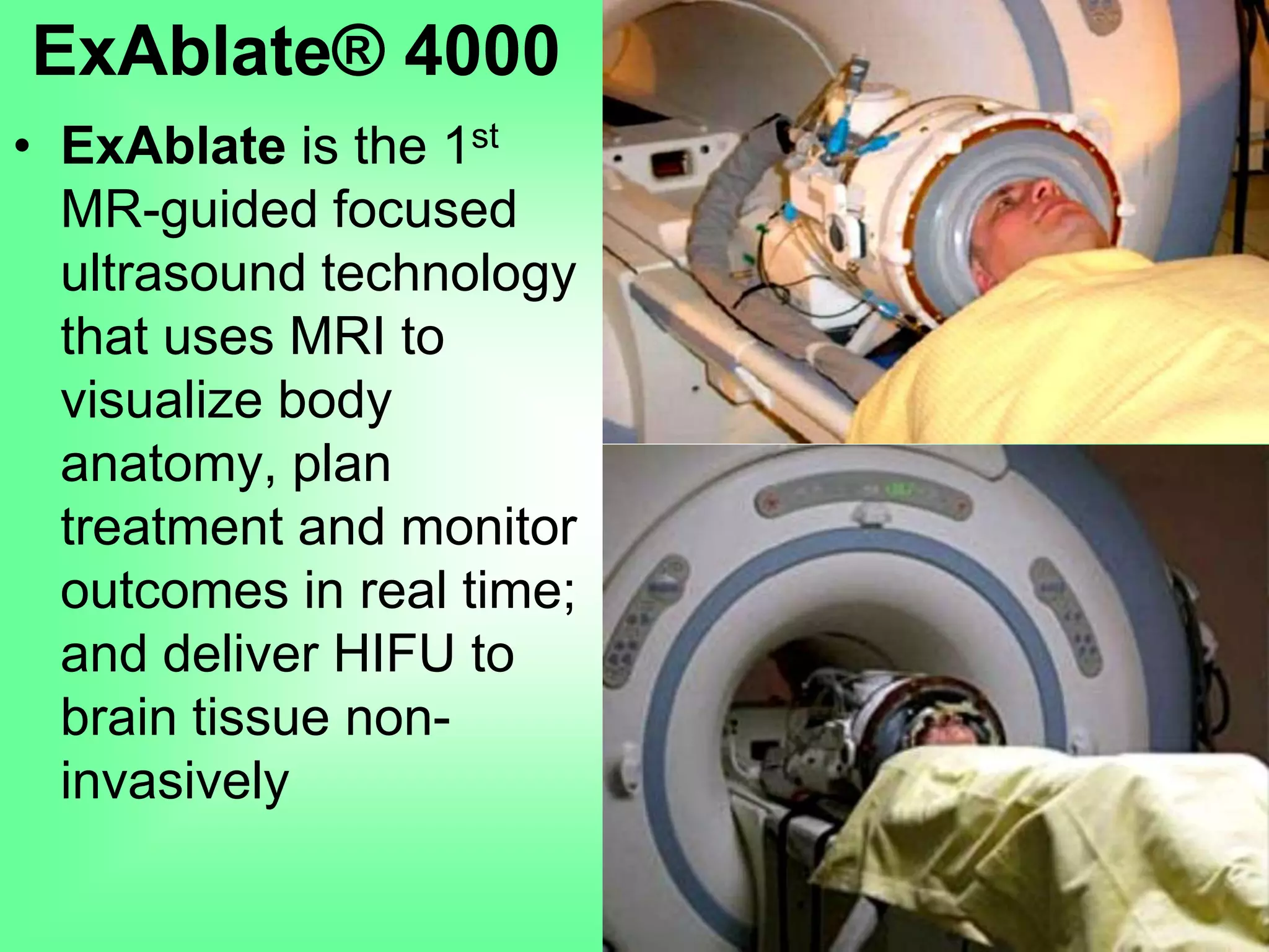 • ExAblate is the 1st
MR-guided focused
ultrasound technology
that uses MRI to
visualize body
anatomy, plan
treatment and monitor
outcomes in real time;
and deliver HIFU to
brain tissue non-
invasively
ExAblate® 4000
 