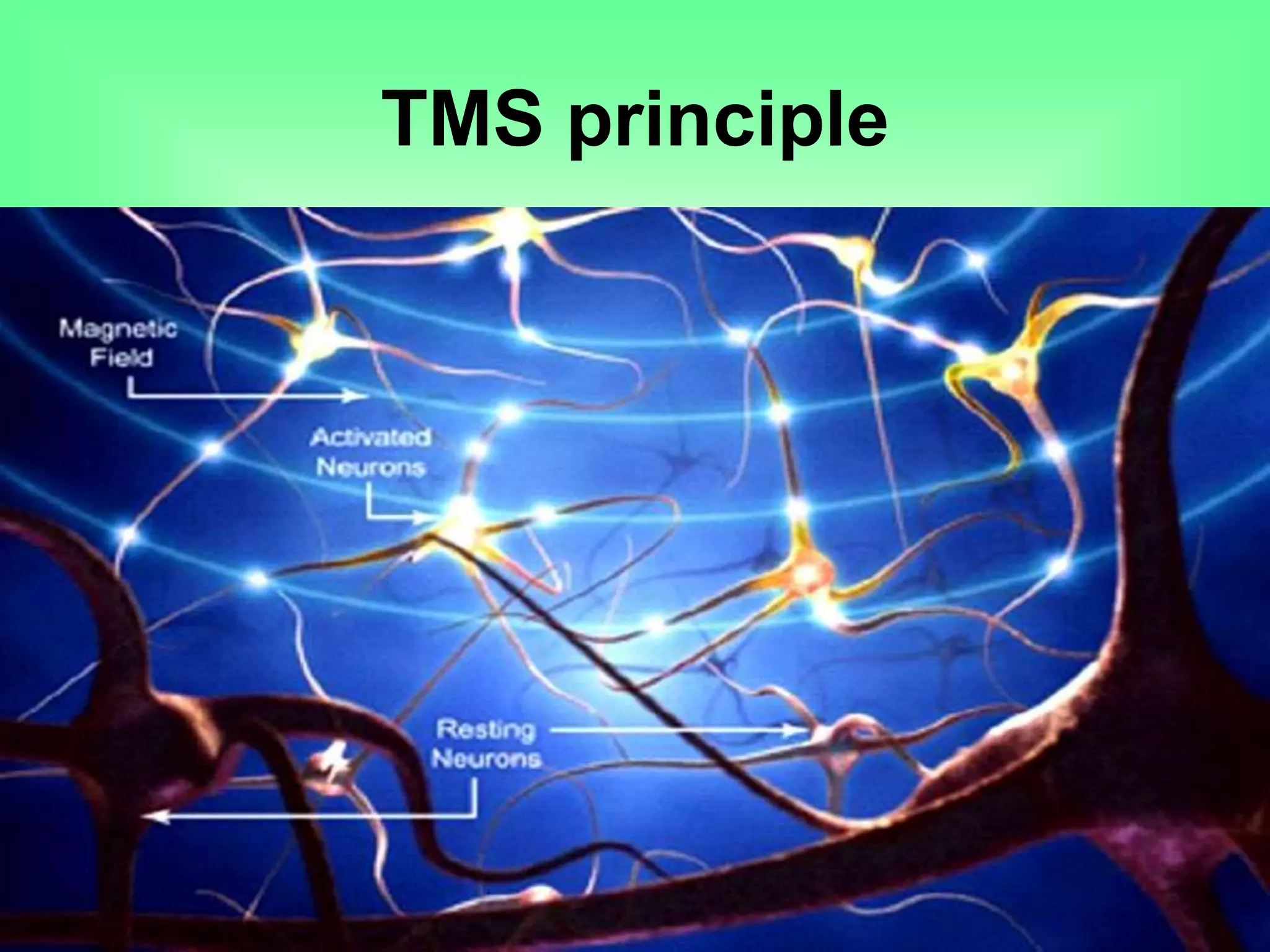 TMS principle
 