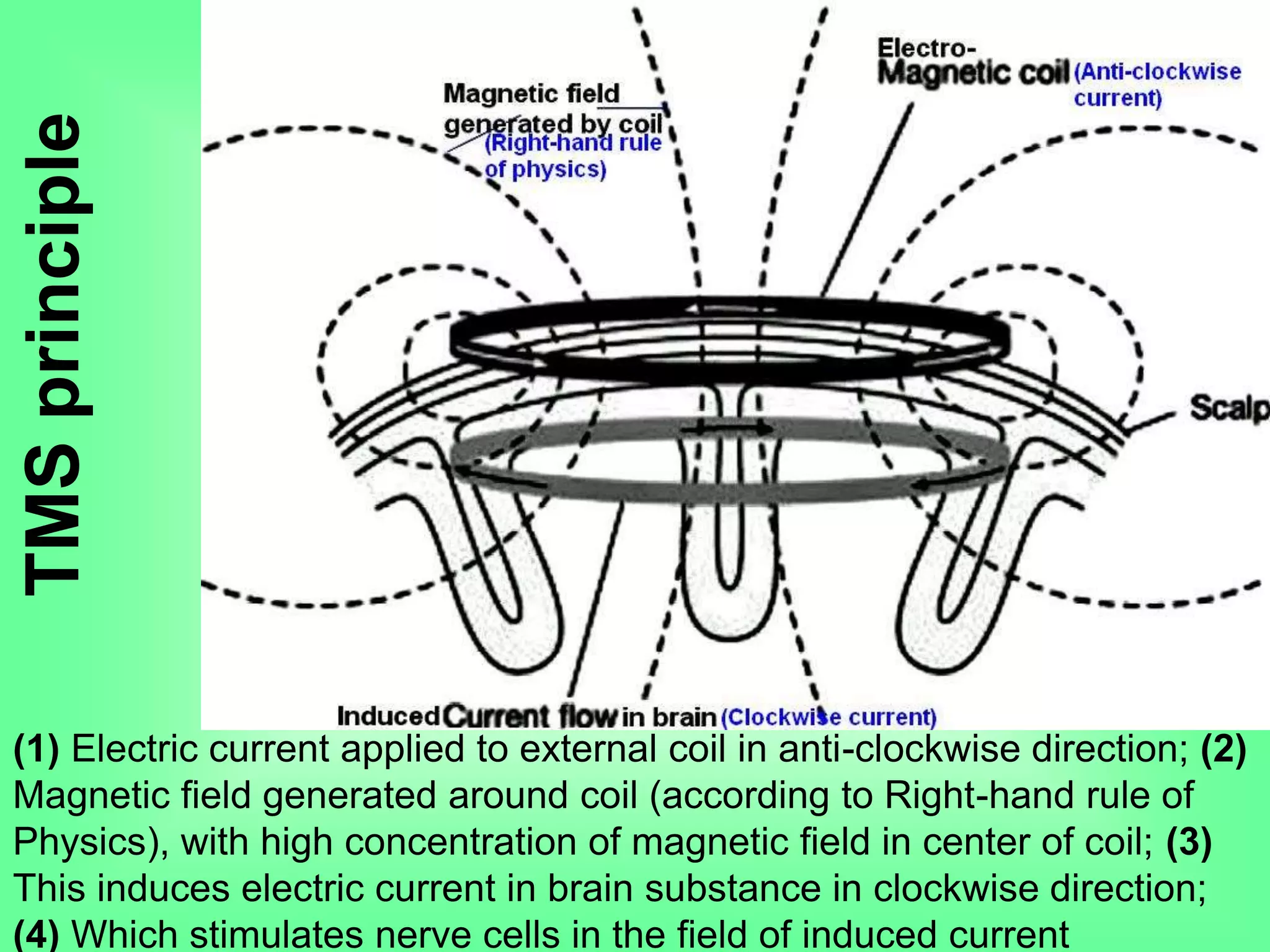 TMSprinciple
(1) Electric current applied to external coil in anti-clockwise direction; (2)
Magnetic field generated around coil (according to Right-hand rule of
Physics), with high concentration of magnetic field in center of coil; (3)
This induces electric current in brain substance in clockwise direction;
(4) Which stimulates nerve cells in the field of induced current
 
